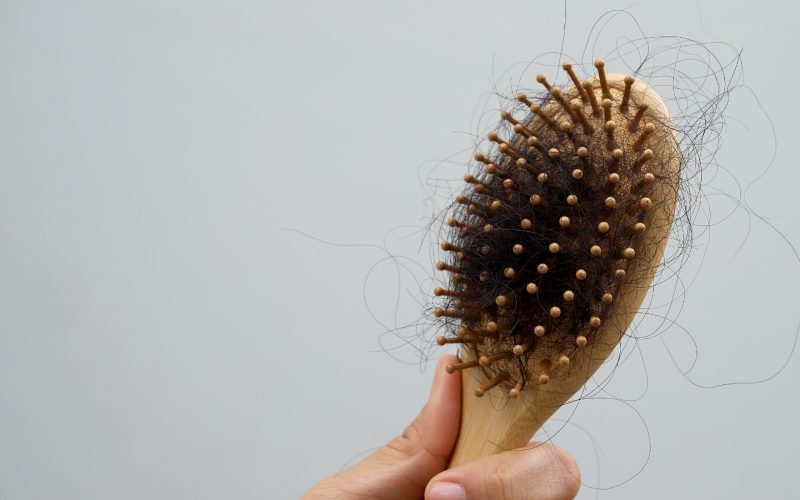 Hair Loss Menopause
